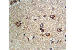 IHC analysis of FFPE human brain tissue stained with CD71 antibody