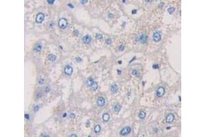 IHC-P analysis of Human Tissue, with DAB staining. (IL-6 Receptor anticorps  (AA 216-356))