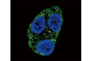 Confocal immunofluorescent analysis of Tyrosinase antibody with HepG2 cells followed by Alexa Fluor 488-conjugated goat anti-rabbit lgG (green).