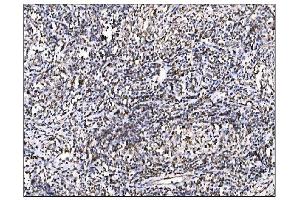 IHC analysis of Ornithine Aminotransferase/OAT using anti-Ornithine Aminotransferase/OAT antibody (ABIN7600649). (OAT anticorps  (AA 214-439))