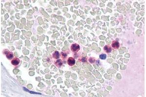 Human Neutrophils: Formalin-Fixed, Paraffin-Embedded (FFPE)