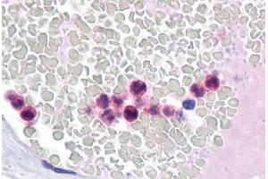 Human Neutrophils: Formalin-Fixed, Paraffin-Embedded (FFPE) (IRF4 anticorps  (AA 342-452))