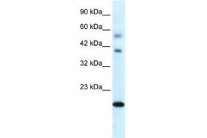 Human heart; WB Suggested Anti-CGI-143 Antibody Titration: 0. (BOLA1 anticorps  (N-Term))