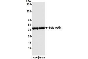 Western Blotting (WB) image for anti-Cytoskeletal Actin (CIMG_00972) (AA 1-50) antibody (ABIN7449436) (Recombinant Cytoskeletal Actin (CIMG_00972) (AA 1-50) anticorps)