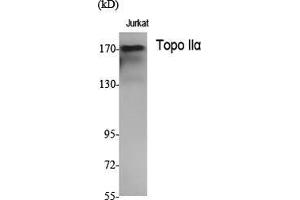 Western Blot (WB) analysis of specific cells using Topo IIalpha Polyclonal Antibody. (Topo IIalpha (N-Term) anticorps)