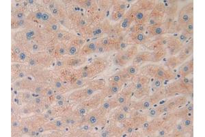 DAB staining on IHC-P; Samples: Human Liver Tissue (Ephrin A5 anticorps  (AA 21-203))