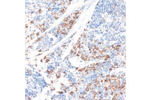Immunohistochemistry of paraffin-embedded mouse spleen using HMGCR antibody (ABIN6293218) at dilution of 1:100 (40x lens). (HMGCR anticorps)