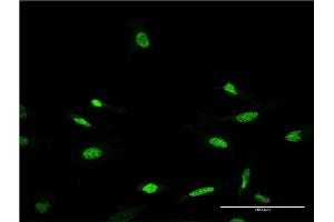 Immunofluorescence of monoclonal antibody to CRX on HeLa cell. (CRX anticorps  (AA 1-299))