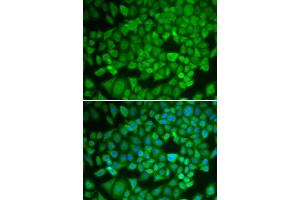 Immunofluorescence analysis of U2OS cell using NR0B1 antibody. (NR0B1 anticorps)