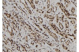 ABIN6277218 at 1/100 staining Human kidney tissue by IHC-P. (EPB41 anticorps  (Internal Region))