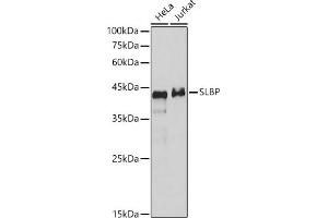 Western blot analysis of various lysates, using SLBP antibody (ABIN7270590) at 1:1000 dilution.