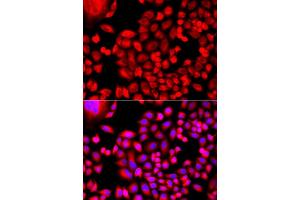 Immunofluorescence analysis of A549 cell using MTHFD1L antibody. (MTHFD1L anticorps)