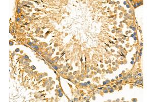 ABIN6264123 and ABIN6266697 at 1/100 staining Rat testis tissue by IHC-P.