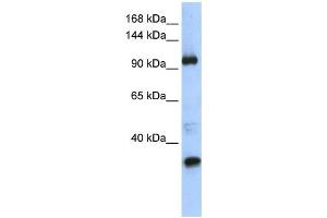 Western Blotting (WB) image for anti-Terminal Uridylyl Transferase 1, U6 SnRNA-Specific (TUT1) antibody (ABIN2458418) (TUT1 anticorps)