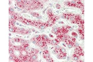 Formalin-fixed and paraffin-embedded H.