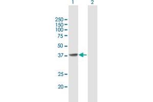 Western Blot analysis of CDK6 expression in transfected 293T cell line by CDK6 MaxPab polyclonal antibody. (CDK6 anticorps  (AA 1-326))