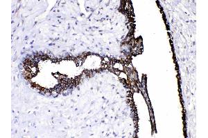 IHC analysis of Caspase8 using anti-Caspase8 antibody .