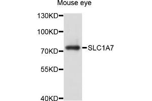 Western blot analysis of extract of mouse eye cells, using SLC1A7 antibody. (SLC1A7 anticorps)