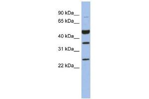 MAGEB3 antibody used at 1 ug/ml to detect target protein. (MAGEB3 anticorps  (N-Term))