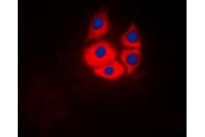 Immunofluorescent analysis of MARK4 staining in Jurkat cells. (MARK4 anticorps  (Center))