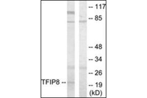 Western blot analysis of extracts from HuvEc cells using TFIP8 Antibody . (TNFAIP8 anticorps)