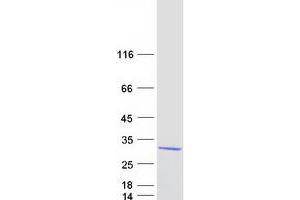 Validation with Western Blot