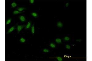 Immunofluorescence of monoclonal antibody to CASP9 on HeLa cell. (Caspase 9 anticorps  (AA 1-416))