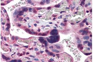 Human Placenta: Formalin-Fixed, Paraffin-Embedded (FFPE) (CAND1 anticorps  (C-Term))