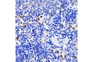 Immunohistochemistry of paraffin-embedded mouse spleen using ANXA1 antibody. (Annexin a1 anticorps)