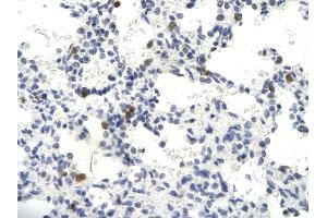 Rabbit Anti-SKIIP antibody        Paraffin Embedded Tissue:  Human Lung cell   Cellular Data:  Epithelial cells of renal tubule  Antibody Concentration:   4.