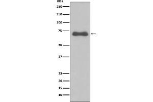 Western blot analysis of NUMB expression in Ramos cell lysate.