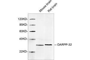 Western blot analysis of tissue lysates using 1 µg/mL DARPP-32 Antibody, pAb, Rabbit (ABIN398905) The signal was developed with IRDyeTM 800 Conjugated Goat Anti-Rabbit IgG.