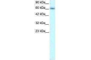 Human Raji; WB Suggested Anti-TRAFD1 Antibody Titration: 0. (TRAFD1 anticorps  (C-Term))