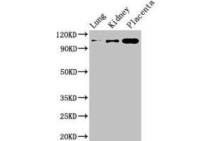 Western Blot Positive WB detected in: Mouse lung tissue, Mouse kidney tissue, Human placenta tissue All lanes: MSH4 antibody at 3 μg/mL Secondary Goat polyclonal to rabbit IgG at 1/50000 dilution Predicted band size: 105 kDa Observed band size: 105 kDa (MSH4 anticorps  (AA 501-800))