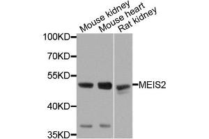 Western blot analysis of extracts of various cells, using MEIS2 antibody. (MEIS2 anticorps)