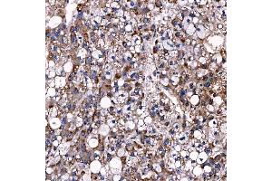 IHC analysis of TTC7B using anti-TTC7B antibody (ABIN7601050). (TTC7B anticorps  (AA 275-730))