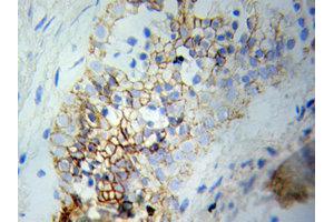 Immunohistochemistry (IHC) image for anti-Mitogen-Activated Protein Kinase 1 (MAPK1) (N-Term) antibody (ABIN1873622)