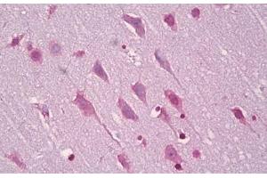 Anti-EFNA5 / Ephrin A5 antibody IHC staining of human brain, cortex neurons. (Ephrin A5 anticorps  (AA 31-80))