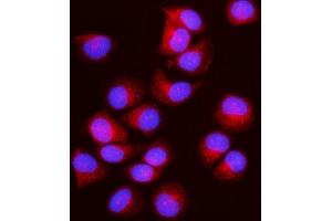 IF analysis of IFT43 using anti-IFT43 antibody (ABIN7599083). (IFT43 anticorps  (AA 1-208))