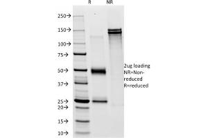 SDS-PAGE Analysis Purified CD28 Mouse Monoclonal Antibody (C28/76). (CD28 anticorps)