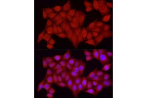 Immunofluorescence analysis of HeLa cells using [KO Validated] PTPN2 Rabbit pAb (ABIN3022584, ABIN3022585, ABIN3022586, ABIN1513448 and ABIN6218927) at dilution of 1:250 (40x lens).