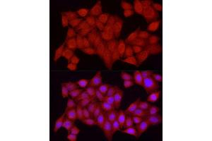 Immunofluorescence analysis of HeLa cells using [KO Validated] PTPN2 Rabbit pAb (ABIN3022584, ABIN3022585, ABIN3022586, ABIN1513448 and ABIN6218927) at dilution of 1:250 (40x lens). (PTPN2 anticorps  (AA 1-353))