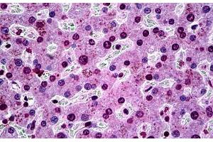 Human Liver: Formalin-Fixed, Paraffin-Embedded (FFPE) (SGK1 anticorps  (AA 1-91))