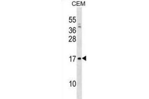 Western Blotting (WB) image for anti-Pre-B Lymphocyte 1 (VPREB1) antibody (ABIN3000848) (VPREB1 anticorps)