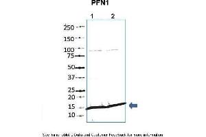 Lanes:   1. (PFN1 anticorps  (N-Term))