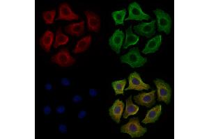 ABIN6260430 and ABIN6279214 staining Hela cells by IF/ICC. (CAMK2D anticorps  (C-Term))