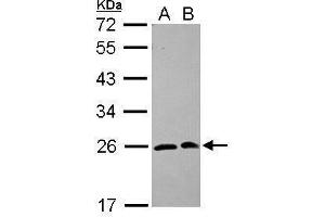 WB Image Sample (30 ug of whole cell lysate) A: 293T B: A431 12% SDS PAGE antibody diluted at 1:1000 (SAR1A anticorps  (Center))