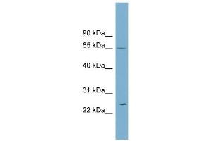 Ribophorin II antibody used at 1 ug/ml to detect target protein. (Ribophorin II anticorps  (Middle Region))