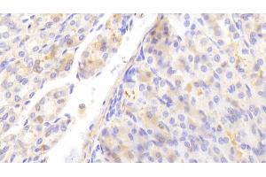 Detection of PEDF in Mouse Stomach Tissue using Polyclonal Antibody to Pigment Epithelium Derived Factor (PEDF)