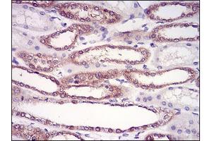 Immunohistochemical analysis of paraffin-embedded kidney tissues using HPRT1 mouse mAb with DAB staining.